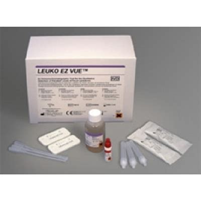 tear lactoferrin test|positive lactoferrin test.